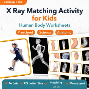 Op de afbeelding: Educatief printbaar PDF-bestand met een röntgenfoto-matchingactiviteit voor kinderen. Het ontwerp bevat de tekst "X Ray Matching Activity for Kids" en "Human Body Worksheets". De afbeelding bevat ook de woorden "Preschool", "Science" en "Anatomy".