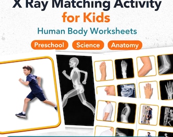 X Ray Matching Activity for Kids | Human Body Science Worksheets (PDF)