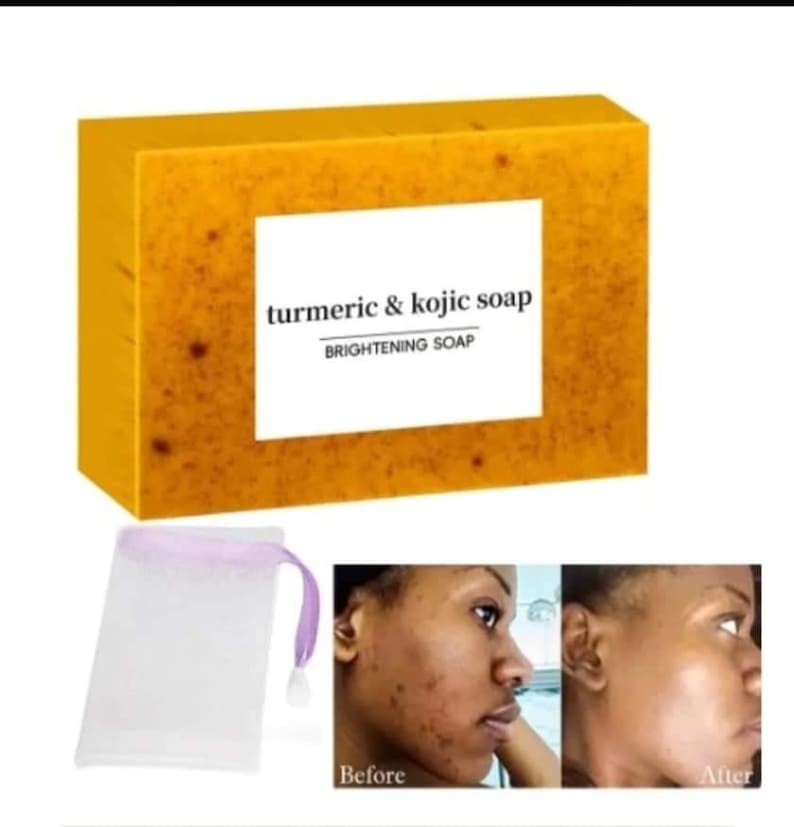 Turmeric Kojic Acid Soap - Etsy