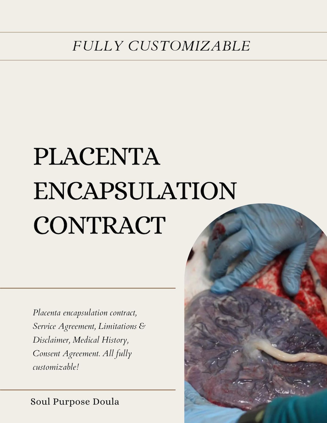 Placenta Encapsulation Contract & Handout Template, Editable Doula ...