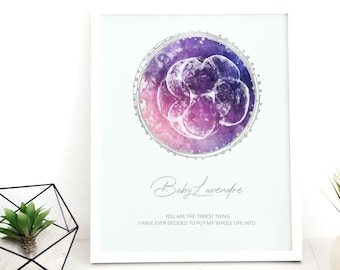 Round Galaxy Watercolor IVF Embryo Art Print - Digital File Incl - New Dad Gift - New Mom Gift - Pregnancy Announcement - Fertility Gift