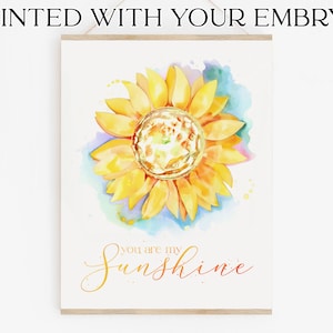 Watercolor Sunshine IVF Embryo Art Print - Hand Painted Embryo - Pregnancy Announcement - Memorial Gift - Embaby - Fertility Gift