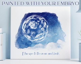 IVF Embryo Portraits