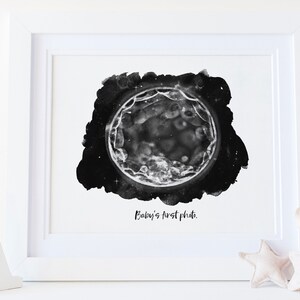 Night Sky Watercolor IVF Embryo Art Print - Digital File Incl - New Dad Gift - New Mom Gift - Pregnancy Announcement - Fertility Gift