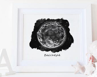 IVF Embryo Art Print – Night Sky Watercolor – Digital Download Included – 6 Color Options