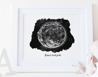 Night Sky Watercolor IVF Embryo Art Print - Digital File Incl - New Dad Gift - New Mom Gift - Pregnancy Announcement - Fertility Gift