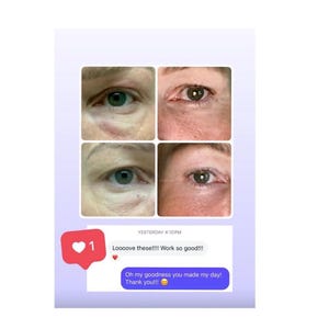 May include: A collage of four close-up images of eyes, with visible changes in the under-eye area. Below, a social media post shows a heart icon with the number 1, and text that reads "Loooove these!!!! Work so good!!!" and "Oh my goodness you made my day! Thank you!!!"