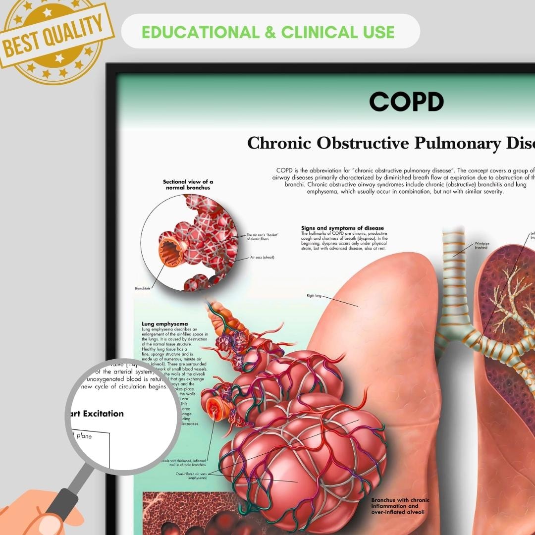 Copd Human COPD Anatomy Poster | Human Biology, Medical Student (digital Download ...