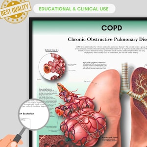 May include: A detailed educational poster illustrating Chronic Obstructive Pulmonary Disease (COPD). The poster shows anatomical diagrams of the lungs and bronchi, with explanatory text. The image is labelled "Educational & Clinical Use". Measurements are not applicable.