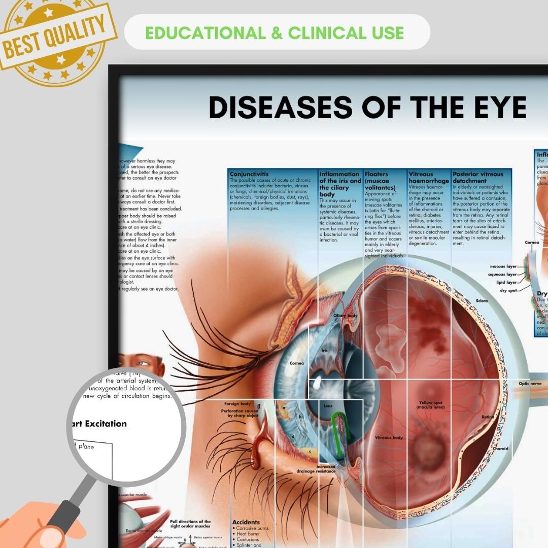 Human Eye Disoder Eye Diseases Anatomy Poster | Medical Biology Print (digital Download ...