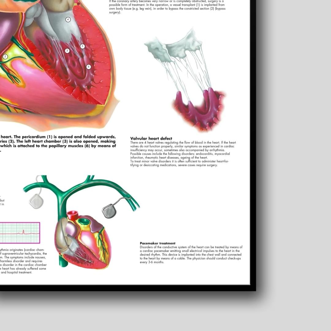 Heart Rhythem Posters Cardiac Disorders Poster Anatomy Human Biology Poster Medical Student ...