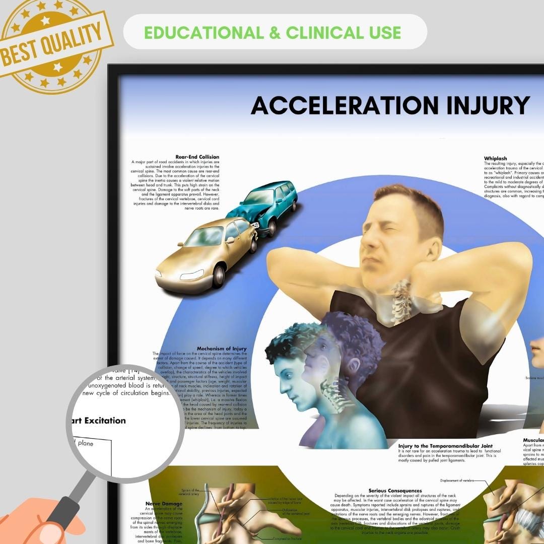Acceleration Injury Anatomy Poster, Medical Biology Art (digital ...