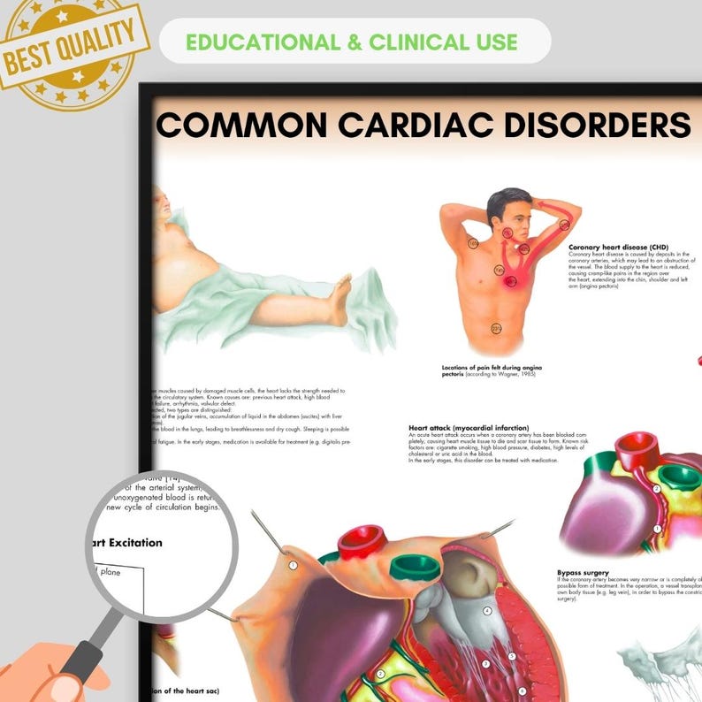 Common Cardios Cardiac Disorders Poster Anatomy Human Biology Poster Medical Student ...