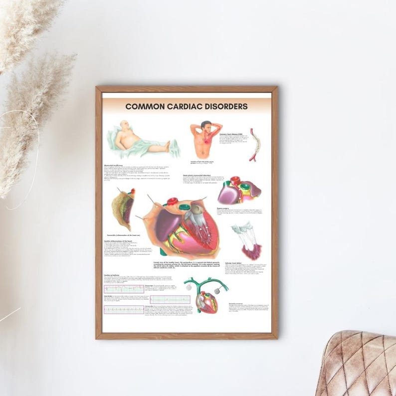 Cardiac Disorders Poster Anatomy Human Biology Poster Medical Student ...