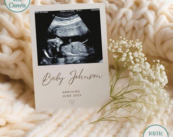 Minimalist Pregnancy Announcement Template: Modern Baby Reveal (Digital Download)