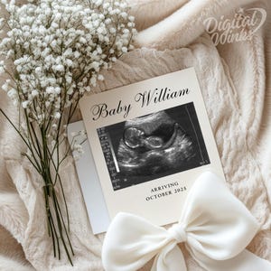 Tarjeta de anuncio de bebé personalizada con foto de ultrasonido. Revelación de embarazo personalizada. Descarga digital. Plantilla minimalista de anuncio de nacimiento.