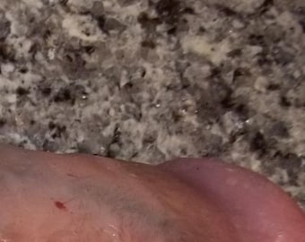 mature 8.5" STP FTM packer prosthetic penis trans