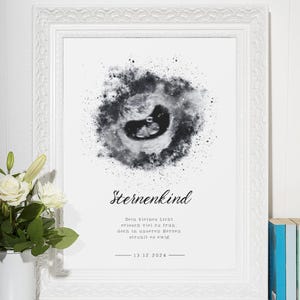 Sternenkind Poster | personalisierter Sternenhimmel mit Ultraschallbild | Erinnerung Andenken Baby | als Download oder Poster in A4 / A3