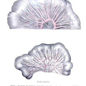1952 Medical Book Page- Human Anatomy- Segment of Jejunum --Medical Print