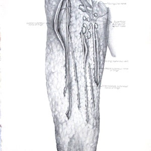 1952 Medical Book Page- Human Anatomy- Superficial Inguinal Lymph Nodes --Medical Print