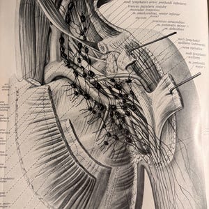 May include: Anatomy illustration of the human neck and shoulder, featuring detailed labeling of muscles, veins, and lymph nodes. The black and white diagram includes text labels and dotted lines, providing a comprehensive view of the anatomical structures.