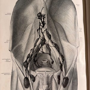 May include: Anatomy illustration of the human abdomen, showing the lymphatic system. The black and white drawing includes labels such as "nodi lymphatici" and "vena saphena magna". The image is from a vintage medical textbook.