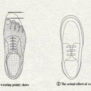 May include: Illustration showing the actual effect of wearing pointy shoes and round head shoes on the shape of the foot. The illustration shows a foot wearing a pointy shoe and a foot wearing a round head shoe.