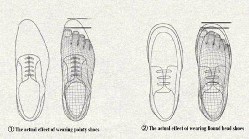 May include: Illustration showing the actual effect of wearing pointy shoes and round head shoes on the shape of the foot. The illustration shows a foot wearing a pointy shoe and a foot wearing a round head shoe.