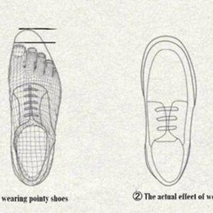 May include: Illustration showing the actual effect of wearing pointy shoes and round head shoes on the shape of the foot. The illustration shows a foot wearing a pointy shoe and a foot wearing a round head shoe.