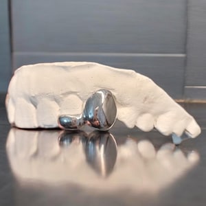Op de afbeelding: Een glanzend, zilveren tandimplantaat wordt getoond naast een witte gipsen tandvorm. Het implantaat heeft een afgeronde kop en een gebogen basis. De achtergrond is een reflecterend oppervlak.