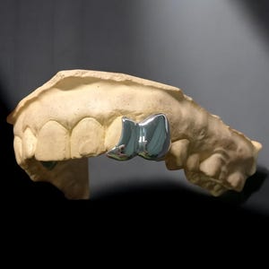 925 silver cap and cutout tooth custom grillz