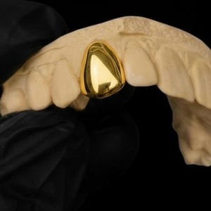 14k gold plated single cap grillz