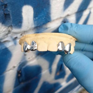 Può includere: Un calco dentale con grillz color argento. I grillz sono attaccati al calco, che è tenuto da una persona che indossa guanti blu. Lo sfondo è un muro con vernice blu e bianca.