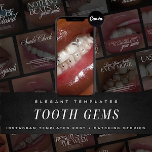 Modèles Instagram de gemmes dentaires : kits de marque de dentiste pour le blanchiment des dents, articles de gemmes et de bijoux dentaires | Modèle de gemmes de dents