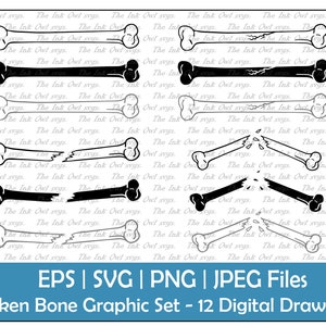 Broken Fractured Bone Vector Clipart Set / Outline & Stamp Drawing Graphic / Human Anatomy / PNG, JPG, SVG, Eps