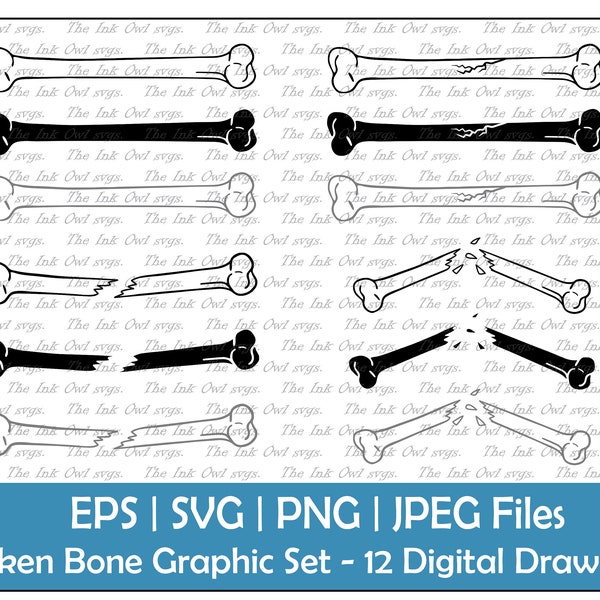 Broken Fractured Bone Vector Clipart Set / Outline & Stamp Drawing Graphic / Human Anatomy / PNG, JPG, SVG, Eps