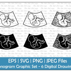 Ultrasound Sonogram Vector Clipart Set / Outline & Silhouette Graphics / Pregnancy and Fertility / Fetus / Diagram / PNG, JPG, SVG, Eps