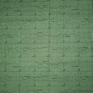 May include: Green fabric with a grid pattern and wavy lines, resembling a scientific graph. The fabric has text labels such as "Calculation," "Deduction," and "Conjecture." The overall design suggests a vintage or academic theme.