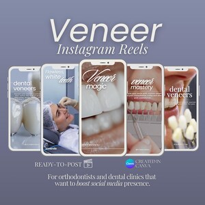 Può includere: Una pubblicità per faccette dentali, con cinque schermi di smartphone che mostrano le parole "Veneer" e "Instagram Reels". Gli schermi mostrano procedure dentistiche e il testo "Flawless, white teeth", "Veneer magic" e "Veneer mastery". Il testo in basso recita "READY-TO-POST" e "CREATED IN CANVA".