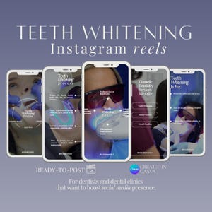 Puede incluir: Imagen promocional para reels de Instagram sobre blanqueamiento dental. La imagen presenta cinco teléfonos inteligentes que muestran información sobre blanqueamiento dental, incluidos datos, procesos y servicios. El texto incluye "Teeth Whitening" y "Ready-to-Post".