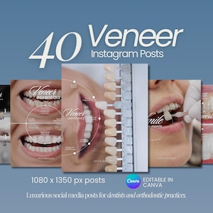 Może przedstawiać: Obraz promocyjny dla postów na Instagramie o licówkach dentystycznych. Obraz przedstawia zbliżenia zębów, przewodniki po odcieniach licówek i nakładki tekstowe. Tekst zawiera "40 postów na Instagramie Veneer", "Veneer essentials" i "Veneer maintenance."