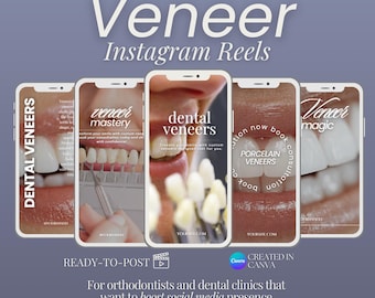 Veneer Instagram Reel Templates: Dentist Social Media Videos (Digital Download)