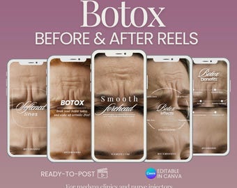 Botox Before & After Reels: Medspa Instagram Templates (Digital Download)