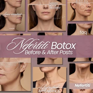 May include: A collage of images showing neck and jawline areas with text overlays including Nefertiti Botox Before & After Posts, Lines smoothed, Nefertiti Botox Treatment, Book appointment now, Botox, faq, Our rejuvenation journey starts here, Refreshed appearance, and Nefertiti Botox effects.