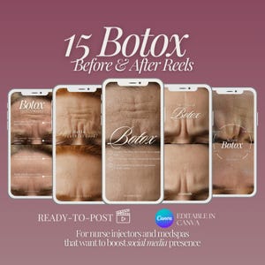 Botox före- och efterbilder: Medspa-innehåll för sociala medier för Canva (digital nedladdning)