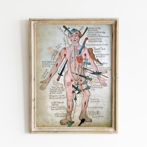 Vintage Medical Illustration - Wound Man - Antique Anatomical Diagram - Medieval Gothic Spooky Surreal Skeleton