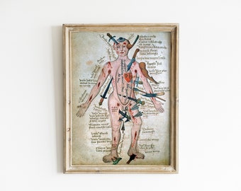 Vintage Medical Illustration - Wound Man - Antique Anatomical Diagram - Medieval Gothic Spooky Surreal Skeleton