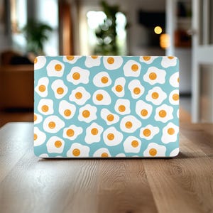 Egg MacBook Case Cute Laptop skin, Cover for MacBook Pro 16, 15, Air 13 14, Gift Protective, Computer Hardshell, Glossy Finish