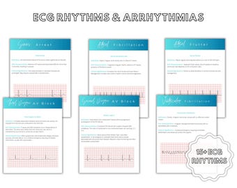 ECG Rhythms & Arrhythmias | EKG Dysarrhythmias | Sinus rhythms | AV Blocks | Ventricular Arrhythmias | Atrial Arrhythmias | Digital download