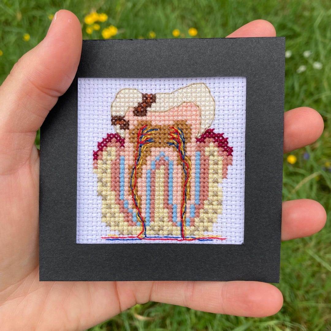 Anatomical Tooth With Cavities Tiny Cross Stitch Pattern: Medical ...